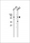 RIPK3 Antibody (Center)